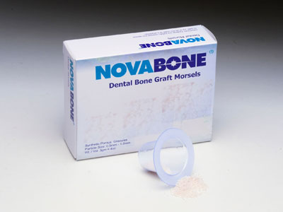 novabone dental morsels novabone dental morsels